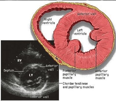 lv parasternal short axis systole|left ventricular systolic diagram.